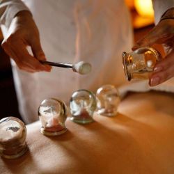 Alexandre GAITERI - Acupuncteur