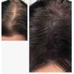 Cabinet libéral ou paramédical - Dermographisme - L'ATELIER ROSE